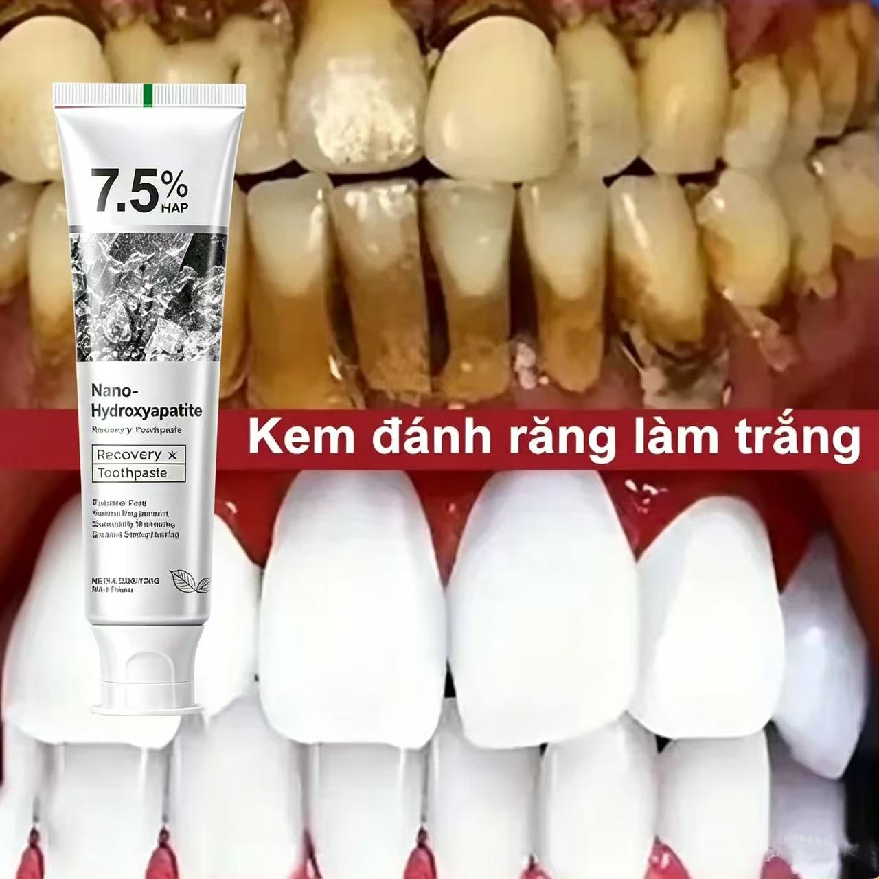 Teeth Whitening Cream - 7.5% Hydroxyapatite Probiotic Whitening Toothpaste Enamel