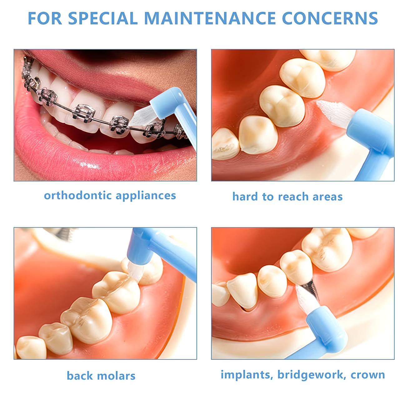 1/3pc Orthodontic Braces Tooth - Teeth Whitening With Braces review and price