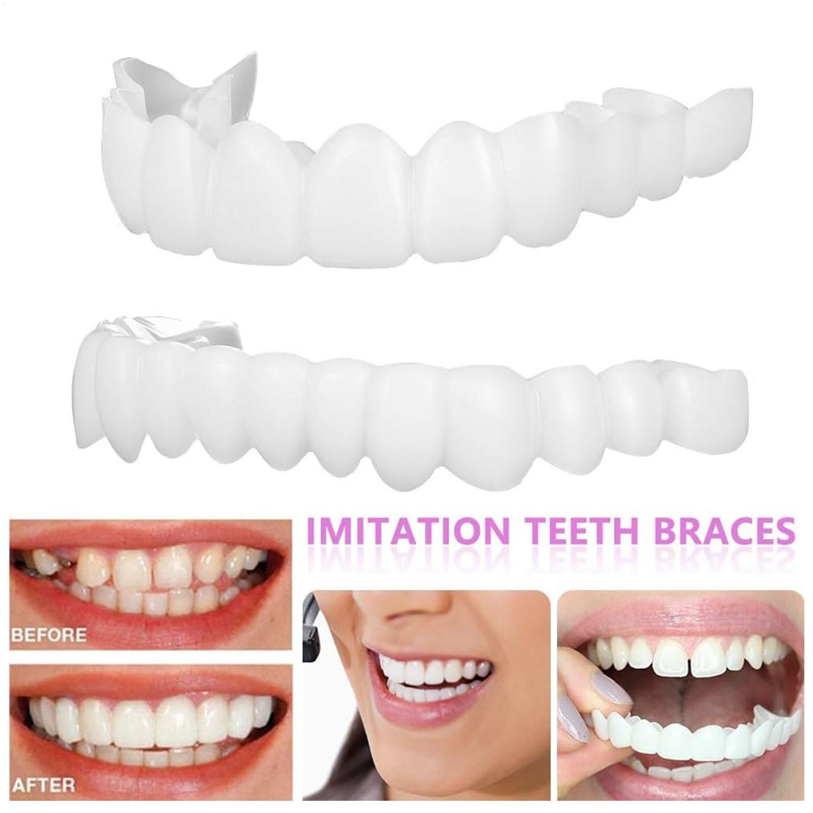 Dental Upper Lower Fake Teeth  - Teeth Whitening With Braces review and price