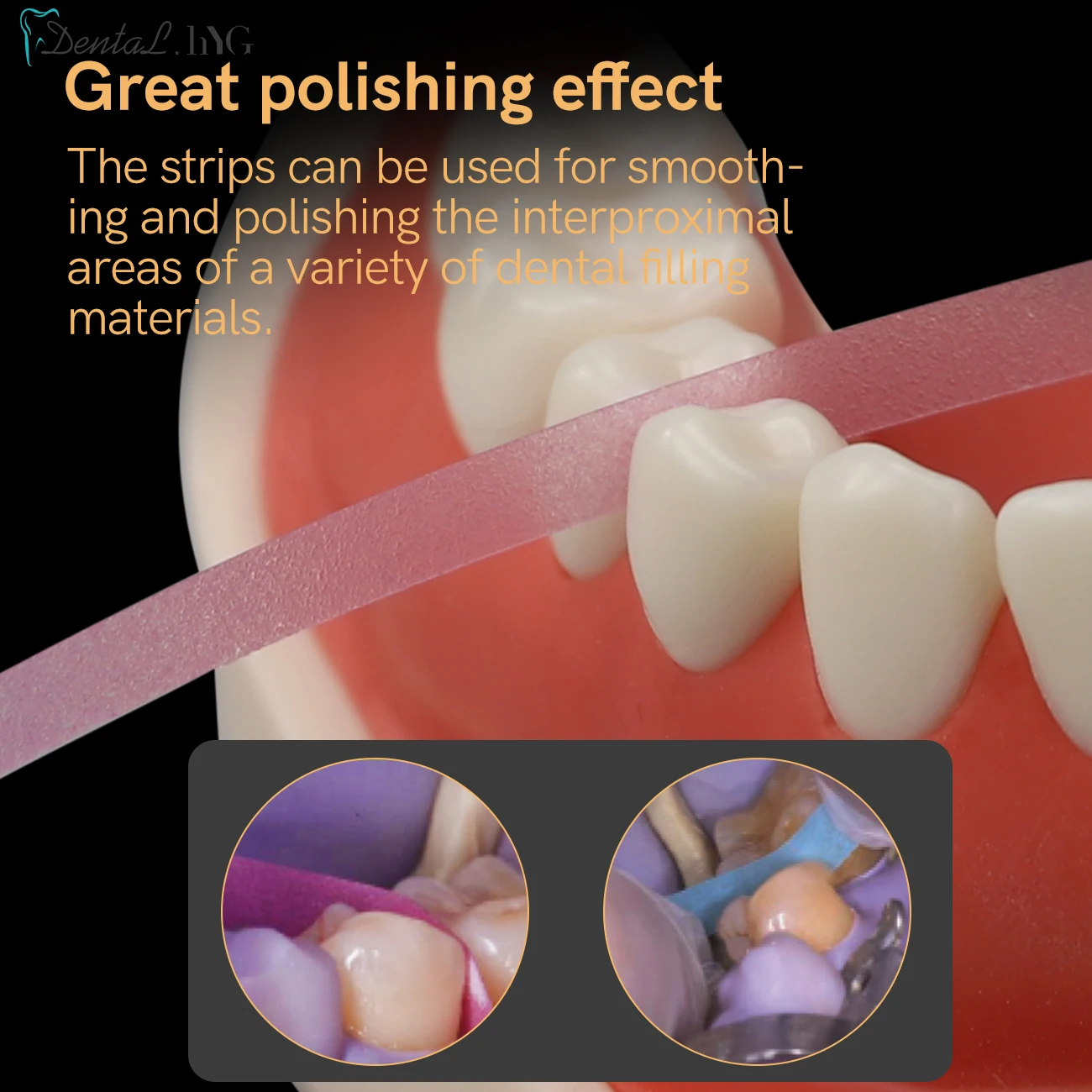 SQDENT Dental Polishing Strip  - Whitening Teeth Dentist review and price
