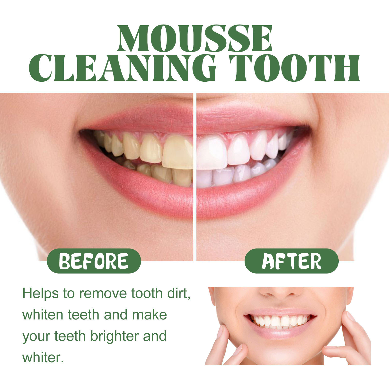 Portable Travel Size Whitening - Teeth Whitening Mousse review and price