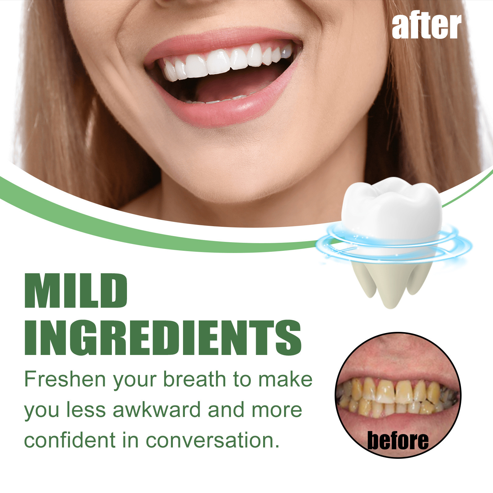 Portable Travel Size Whitening - Teeth Whitening Mousse review and price