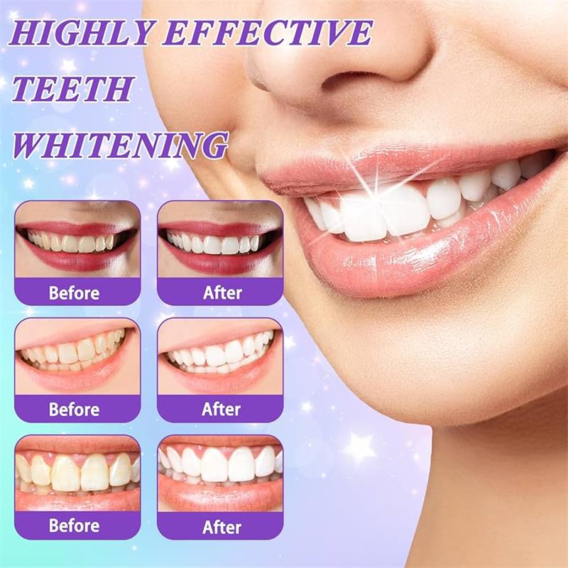 9D Purple Teeth Whitening Toot - Teeth Whitening Mousse review and price