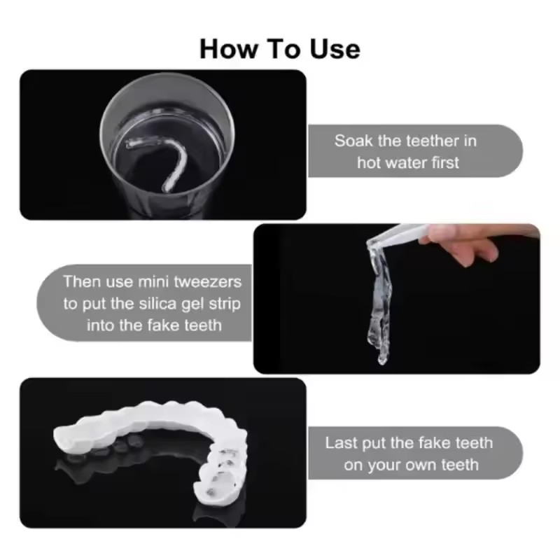 Teeth Veneers Whitening Dentur - Teeth Whitening With Braces review and price