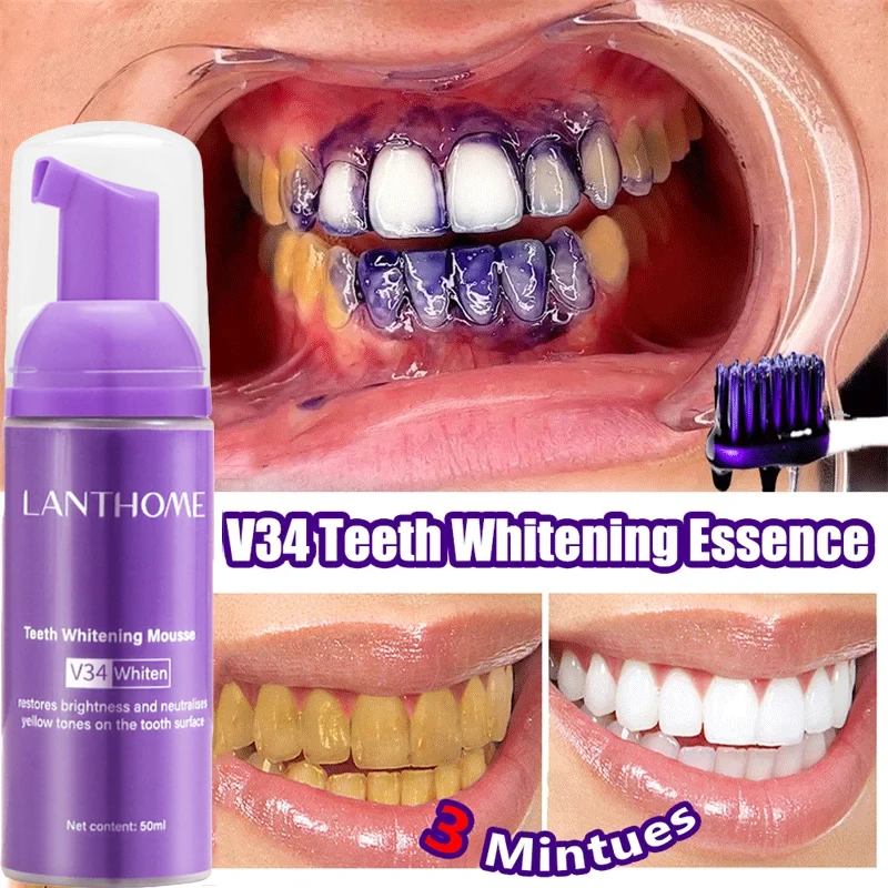 V34 Teeth Whitening Mousse Too - Teeth Whitening Mousse review and price