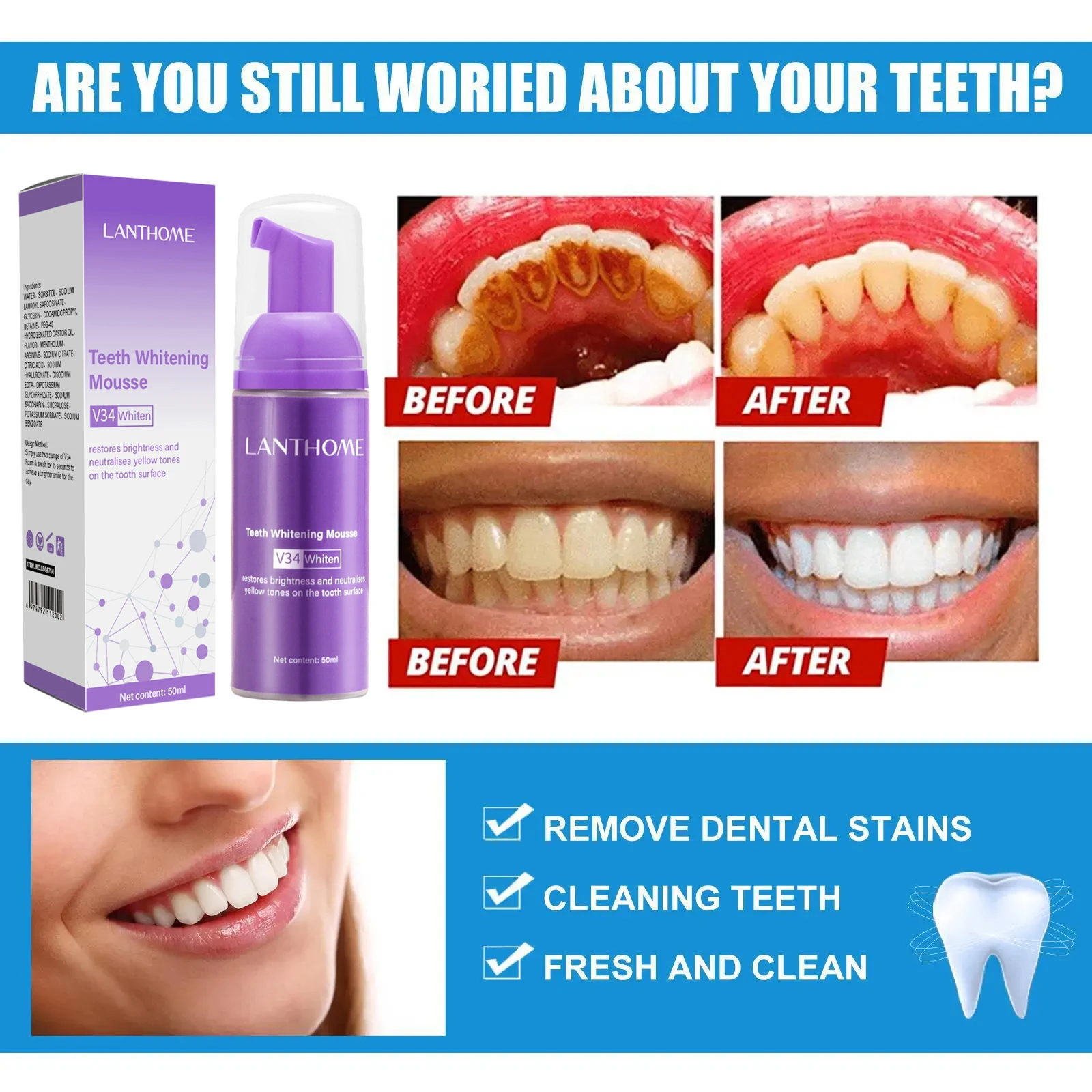 V34 Teeth Whitening Mousse Too - Teeth Whitening Mousse review and price