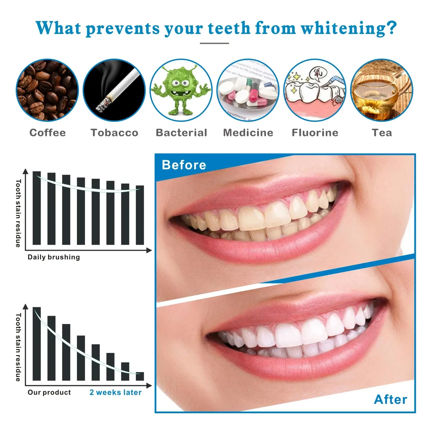 14/28pcs 3D Teeth Whitening St - Whitening Strip 3D review and price