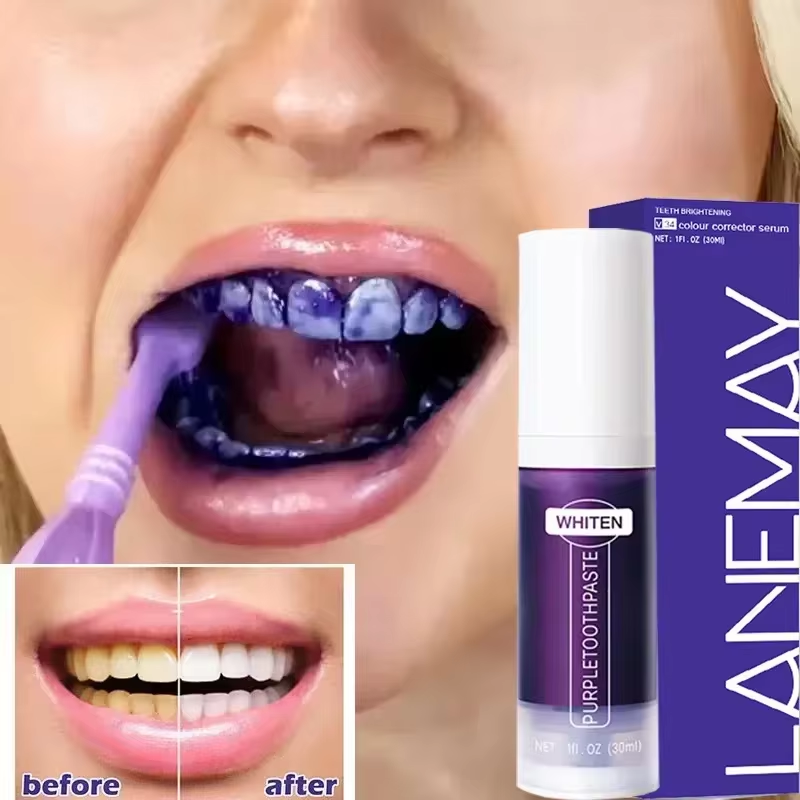 V34 Purple Teeth Whitening Too - Teeth Whitening Mousse review and price