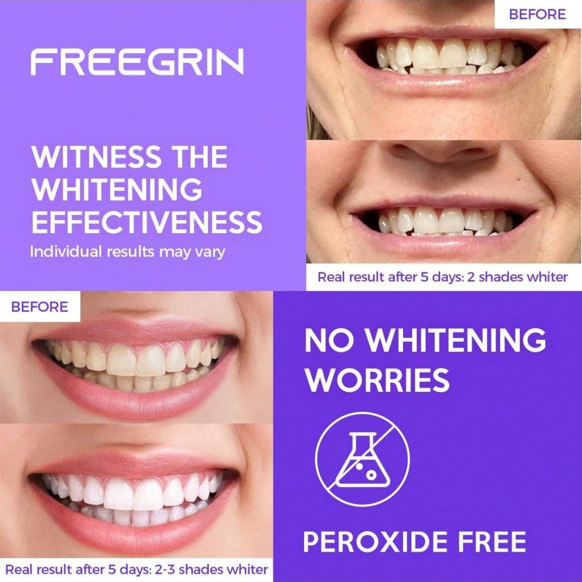 Deluxe Whitening Teeth Sticker - Teeth Whitening Q&M review and price