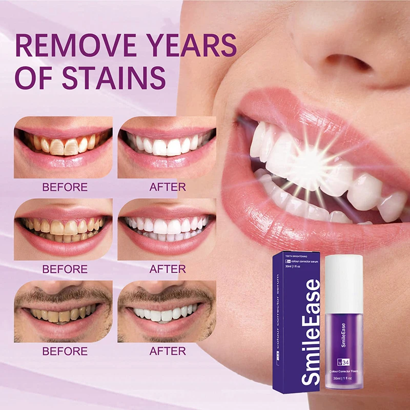 45ml Smilekit Purple Tooth Mou - Teeth Whitening Mousse review and price