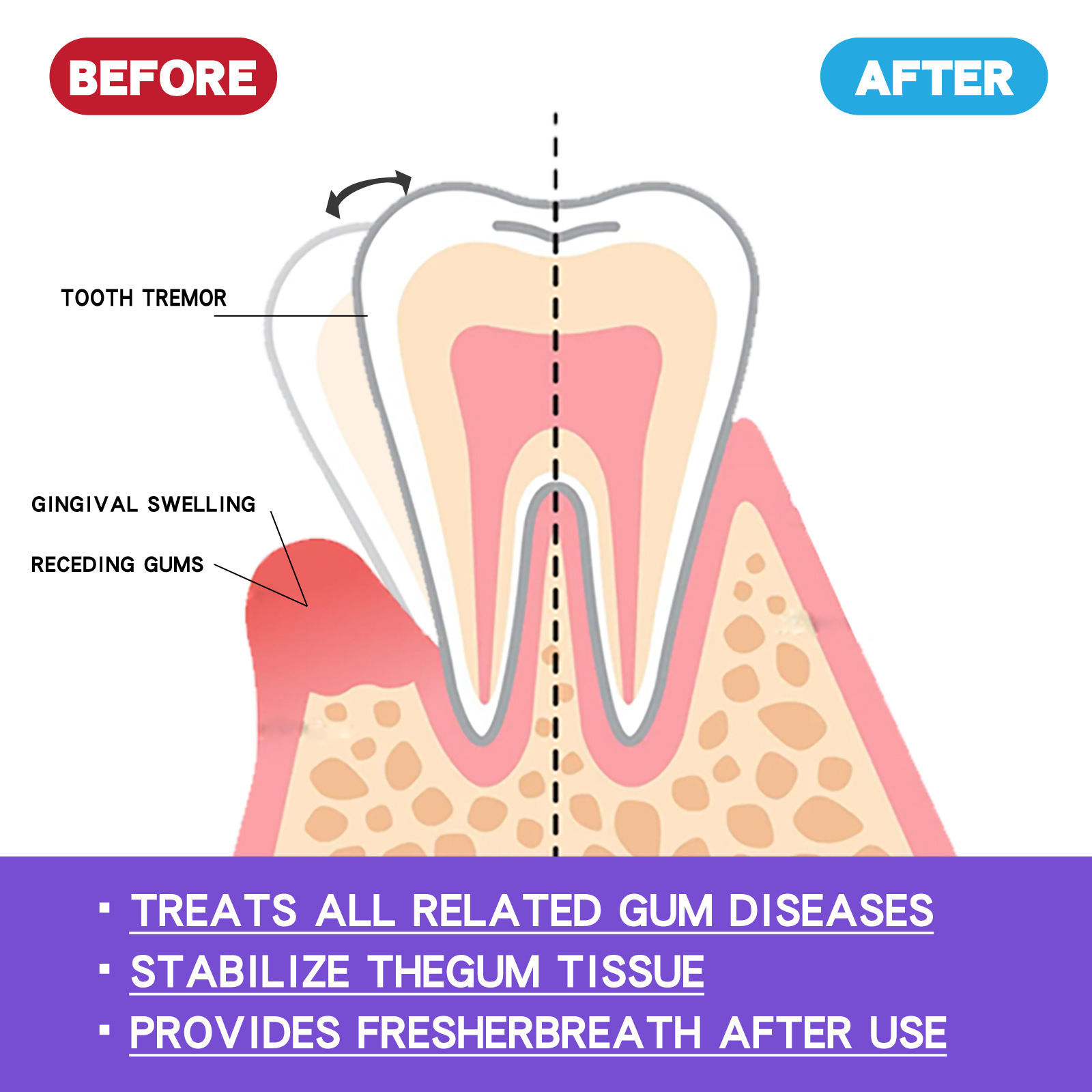 60ml Teeth Whitening Mousse V3 - Teeth Whitening Mousse review and price