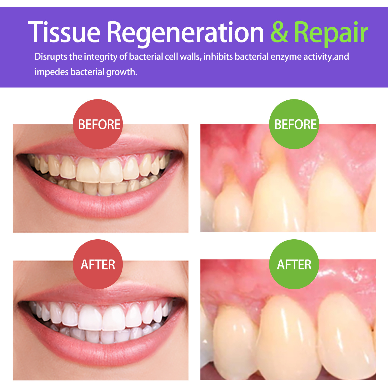 60ml Teeth Whitening Mousse V3 - Teeth Whitening Mousse review and price