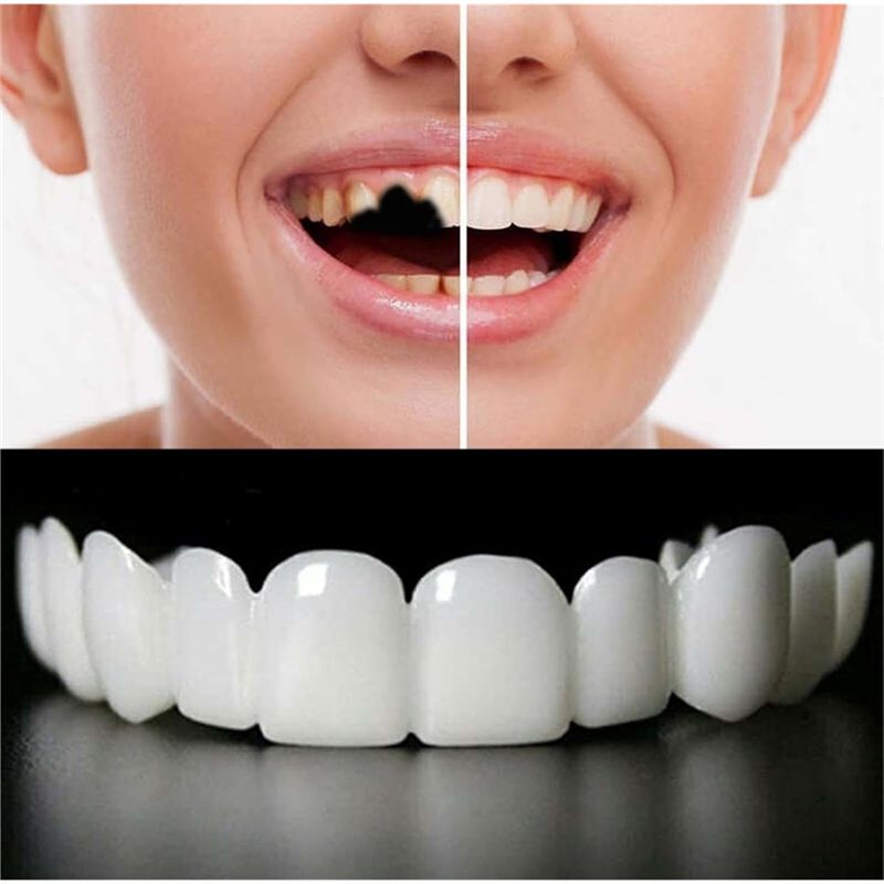 [NEW!ABMK】 2 Pairs,Regain Beau - Teeth Whitening With Braces review and price