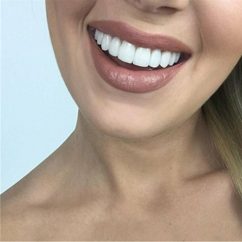 On Smile Dental Upper Lower Fa - Teeth Whitening With Braces review and price