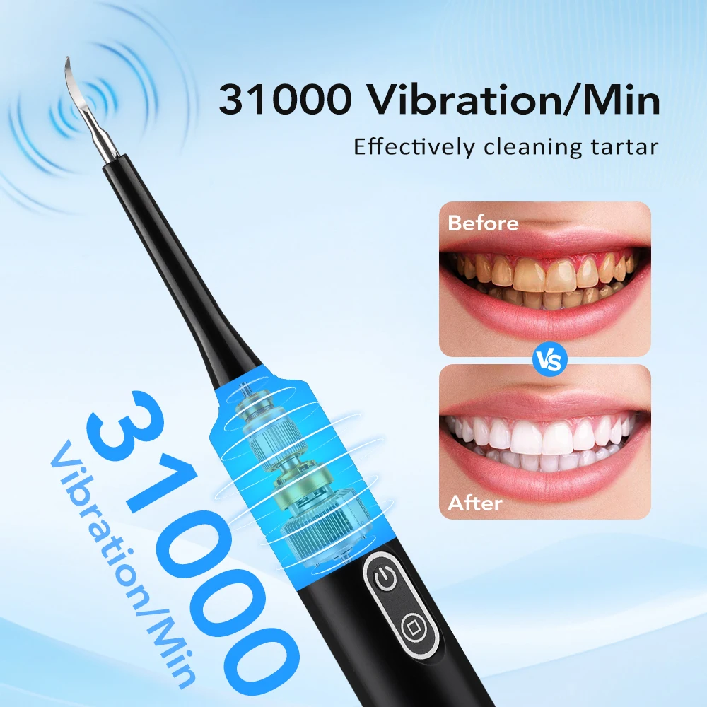 Electric Sonic Vibration Denta - Whitening Teeth Dentist review and price
